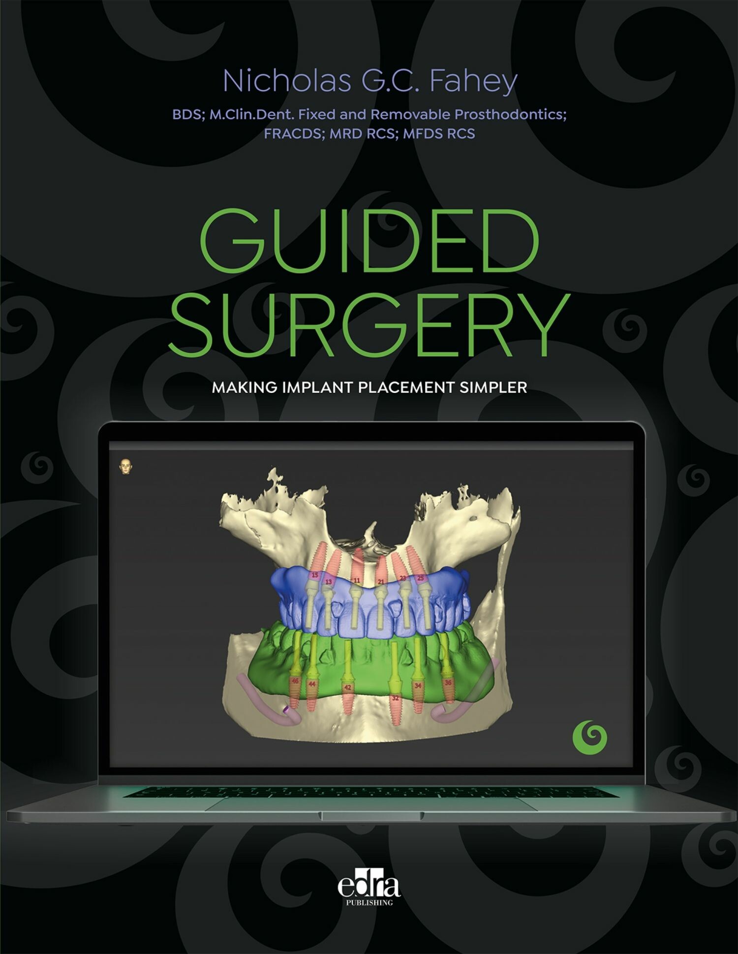Cover Guided surgery