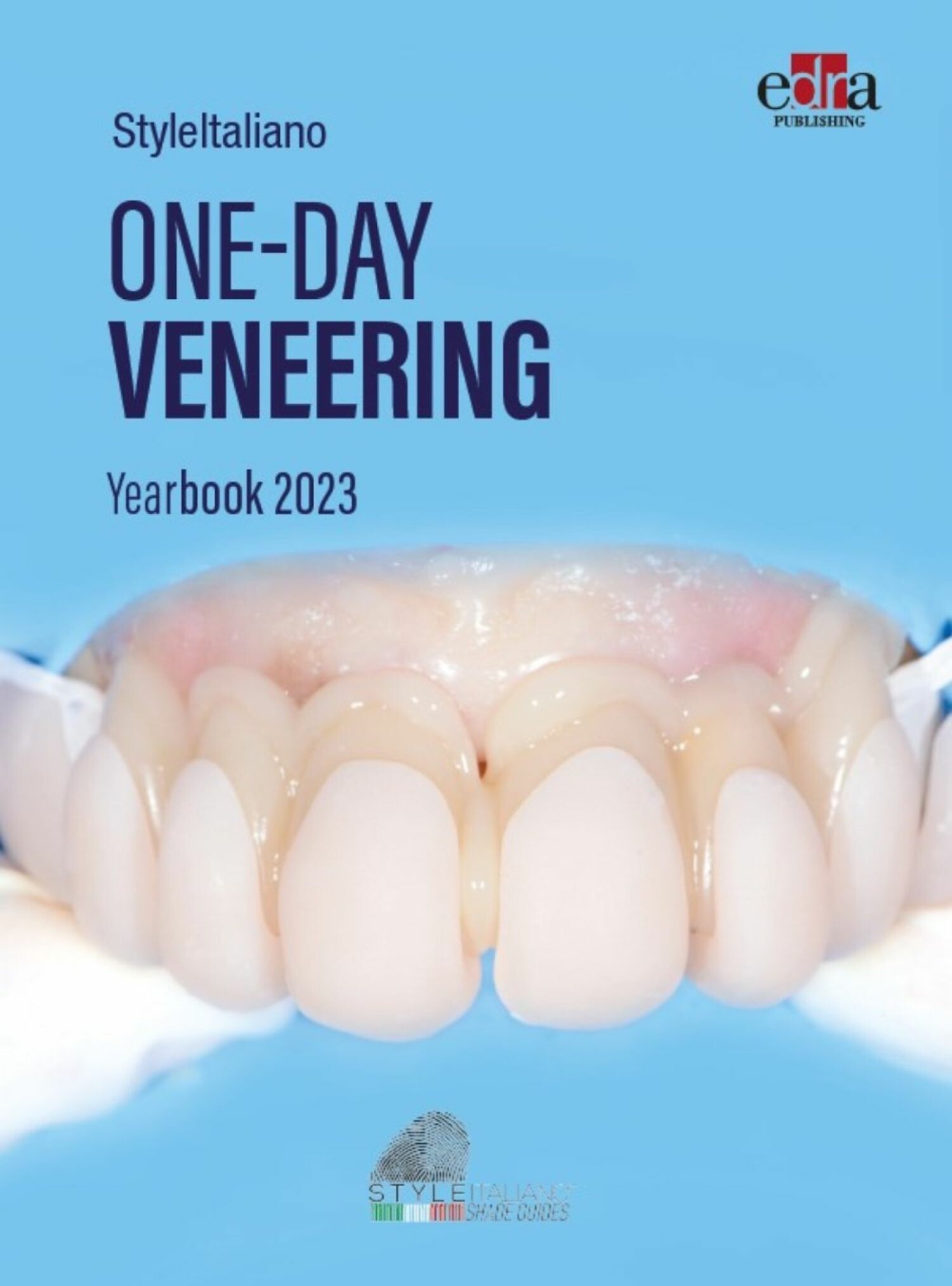 Cover One-day Veneering