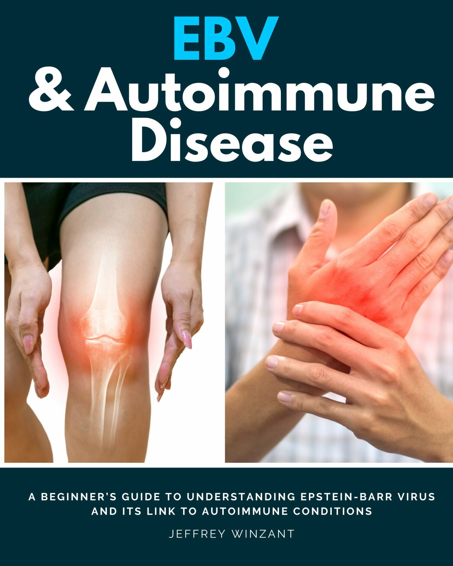 Cover EBV & Autoimmune Disease