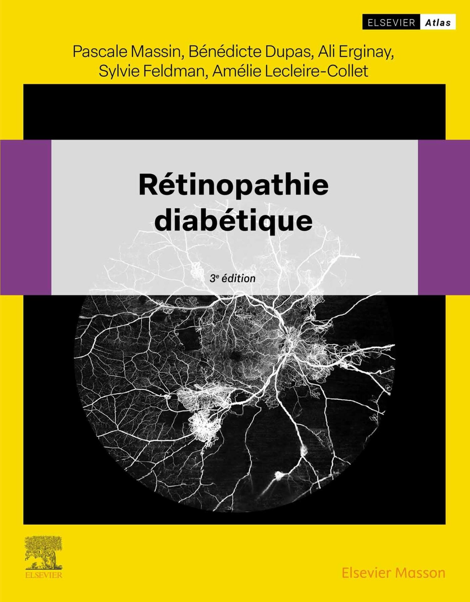 Cover R‚tinopathie diab‚tique