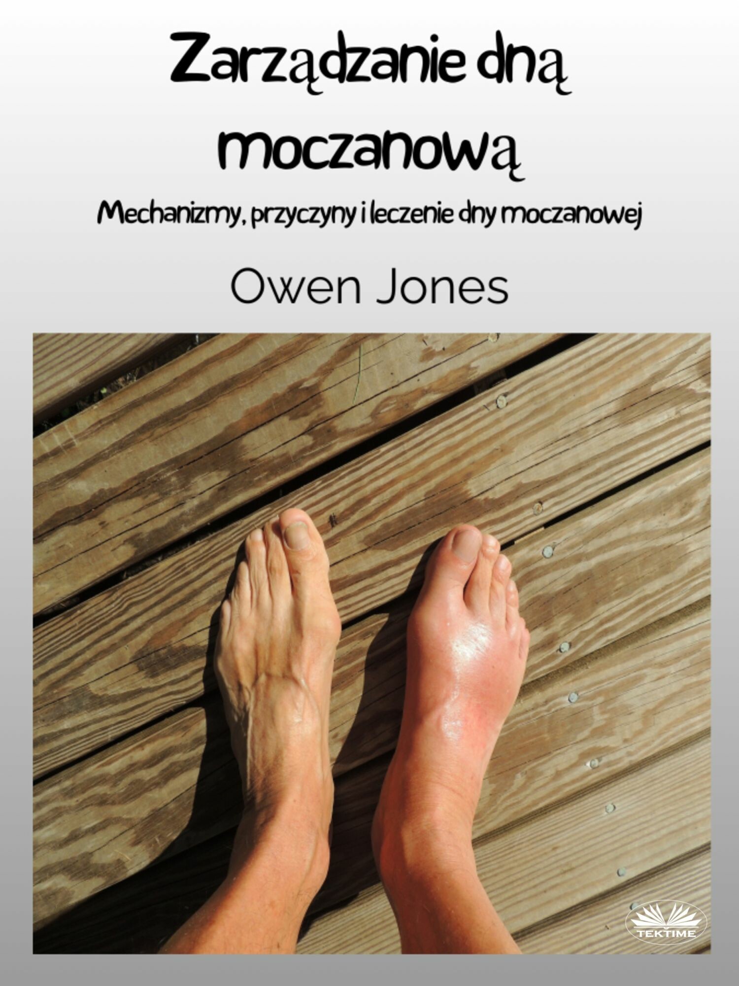 Cover Zarzadzanie Dna Moczanowa