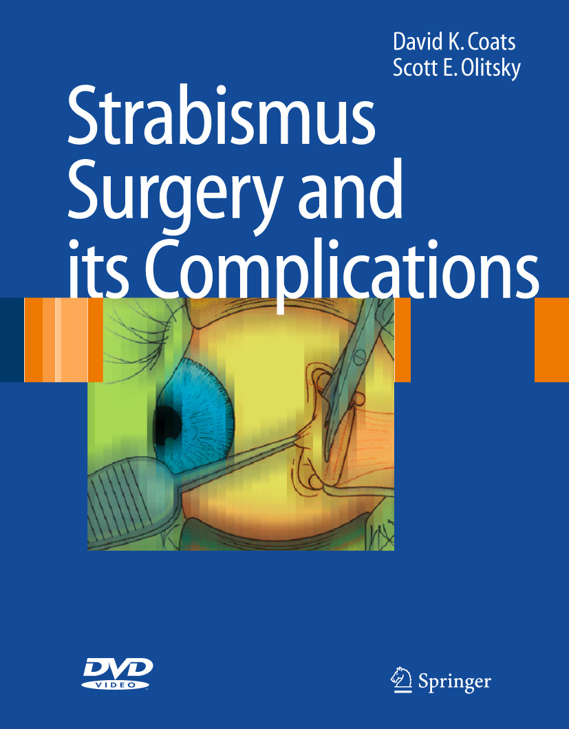 Strabismus Surgery and its Complications EBook