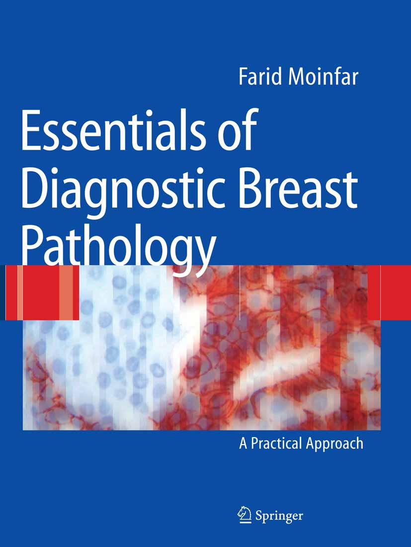 Essentials of Diagnostic Breast Pathology