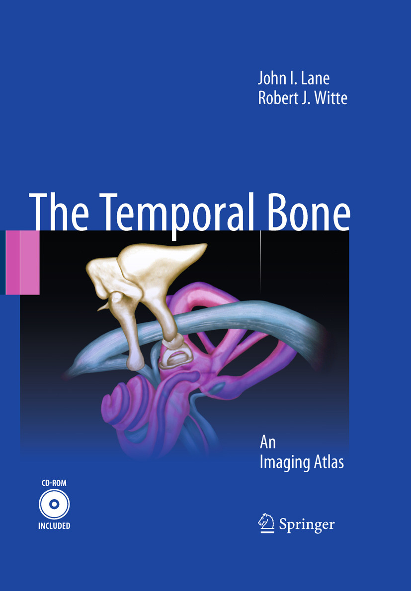 Cover Temporal Bone