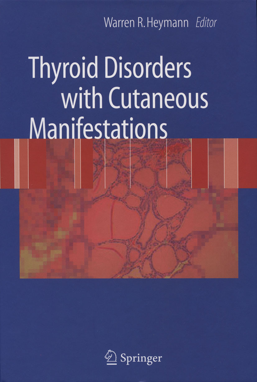 Cover Thyroid Disorders with Cutaneous Manifestations