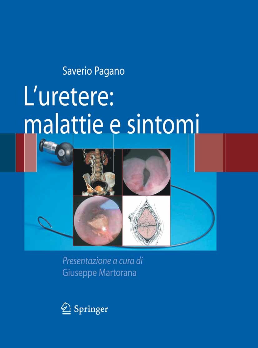 Cover L'uretere: malattie e sintomi