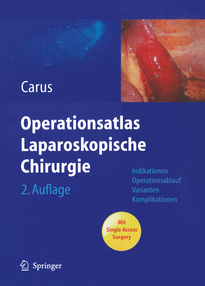 Cover Operationsatlas Laparoskopische Chirurgie