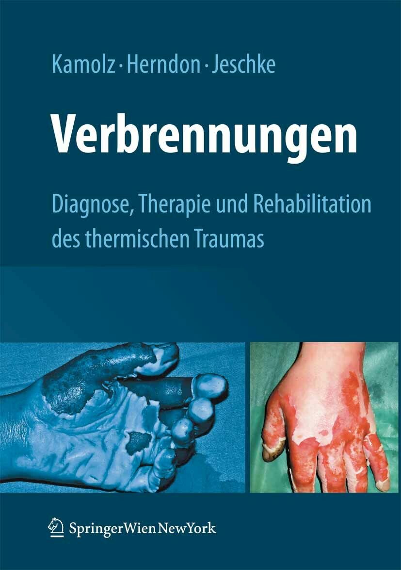 Cover Verbrennungen