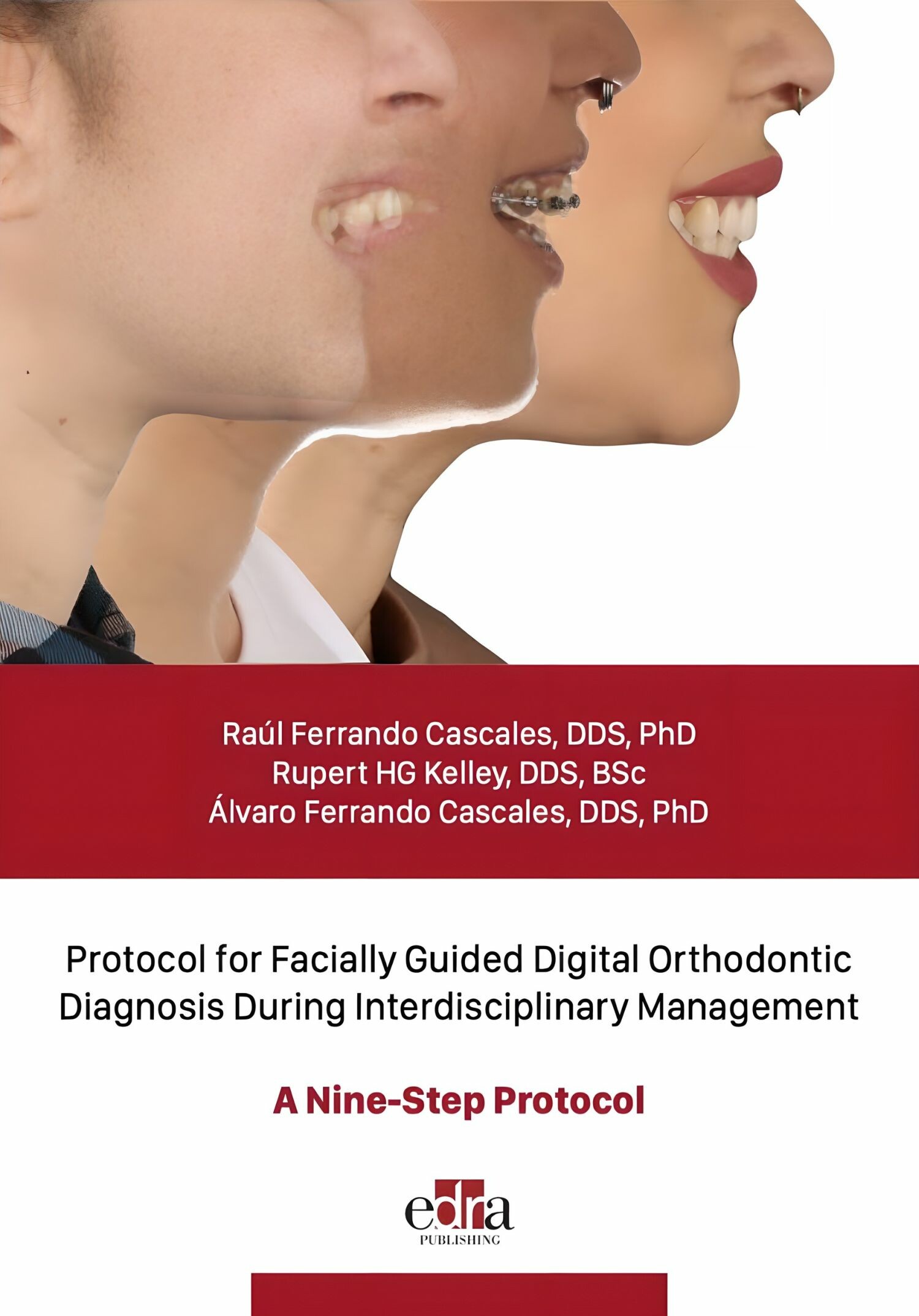 Cover Protocol for Facially Guided Digital Orthodontic Diagnosis During Interdisciplinary Management - A Nine-Step Protocol