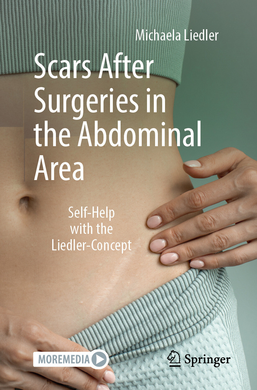 Cover Scars After Surgeries in the Abdominal Area