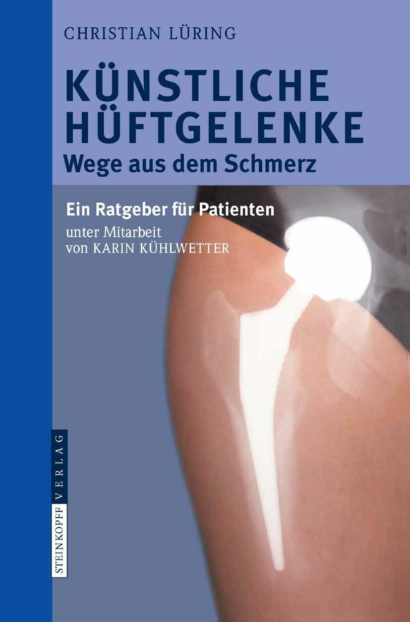 Cover Künstliche Hüftgelenke