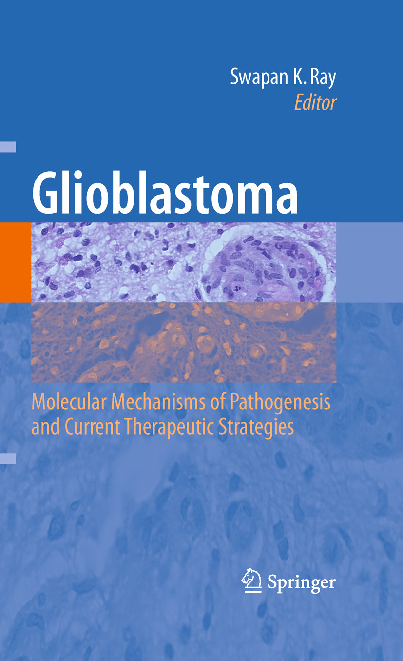 Cover Glioblastoma: