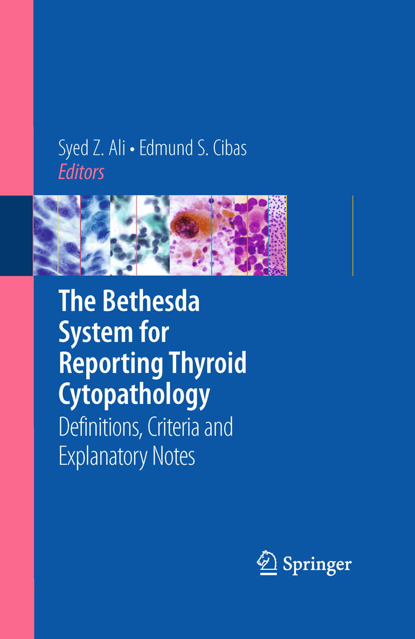 The Bethesda System for Reporting Thyroid Cytopathology