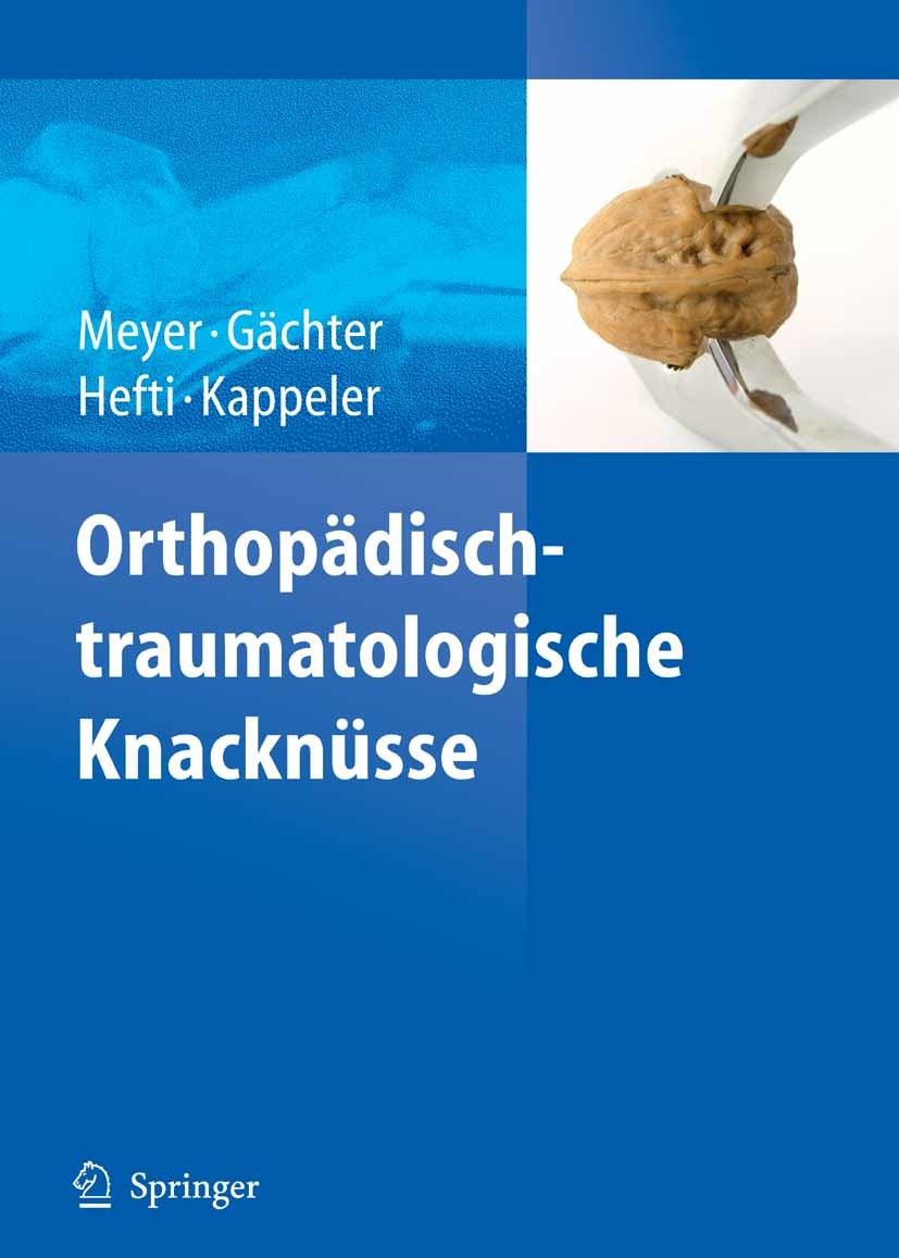 Cover Orthopädisch-traumatologische Knacknüsse