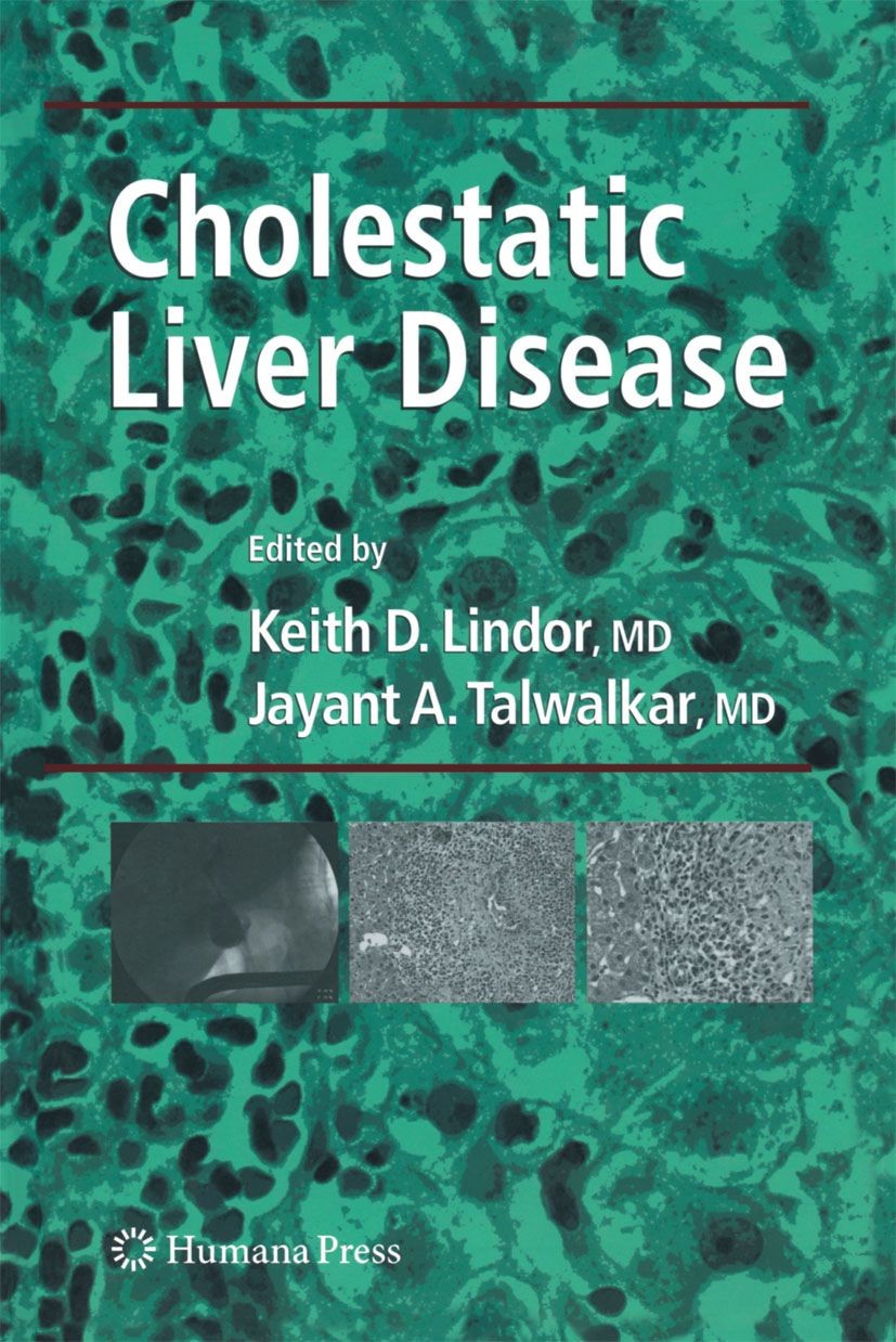 Cover Cholestatic Liver Disease