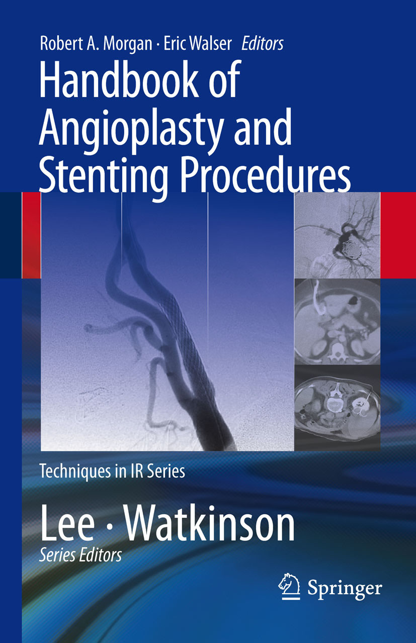 Cover Handbook of Angioplasty and Stenting Procedures