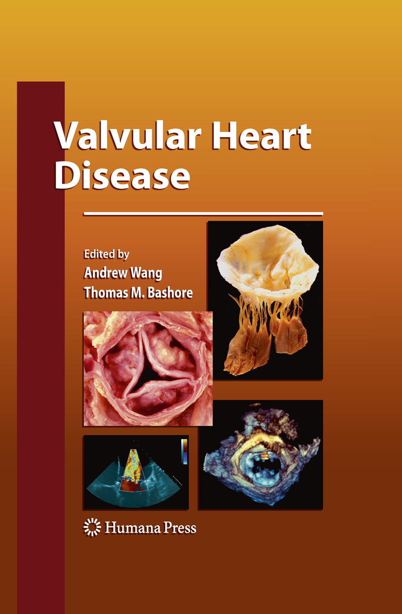 Cover Valvular Heart Disease