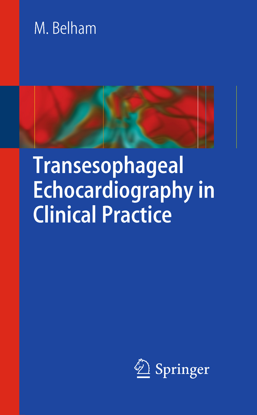 Transesophageal Echocardiography in Clinical Practice