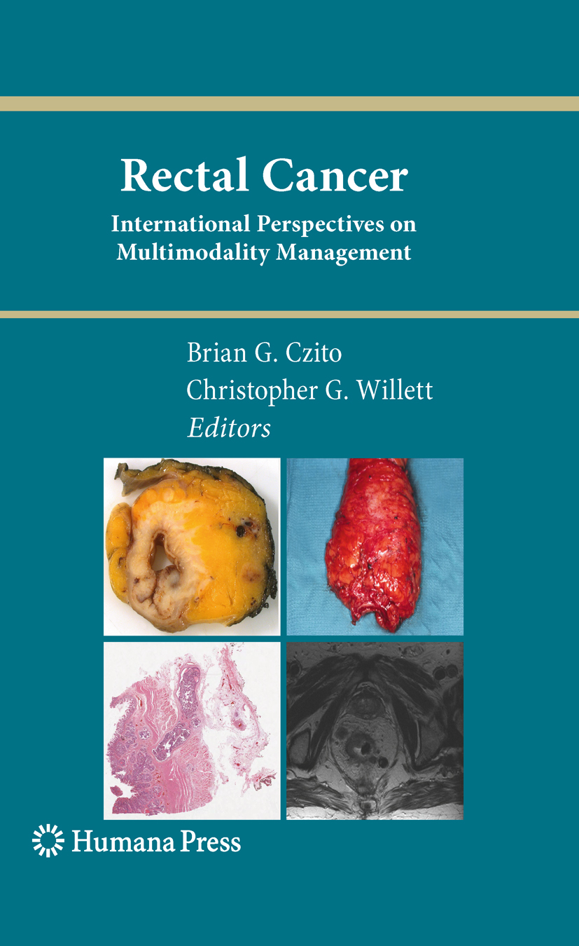 Cover Rectal Cancer