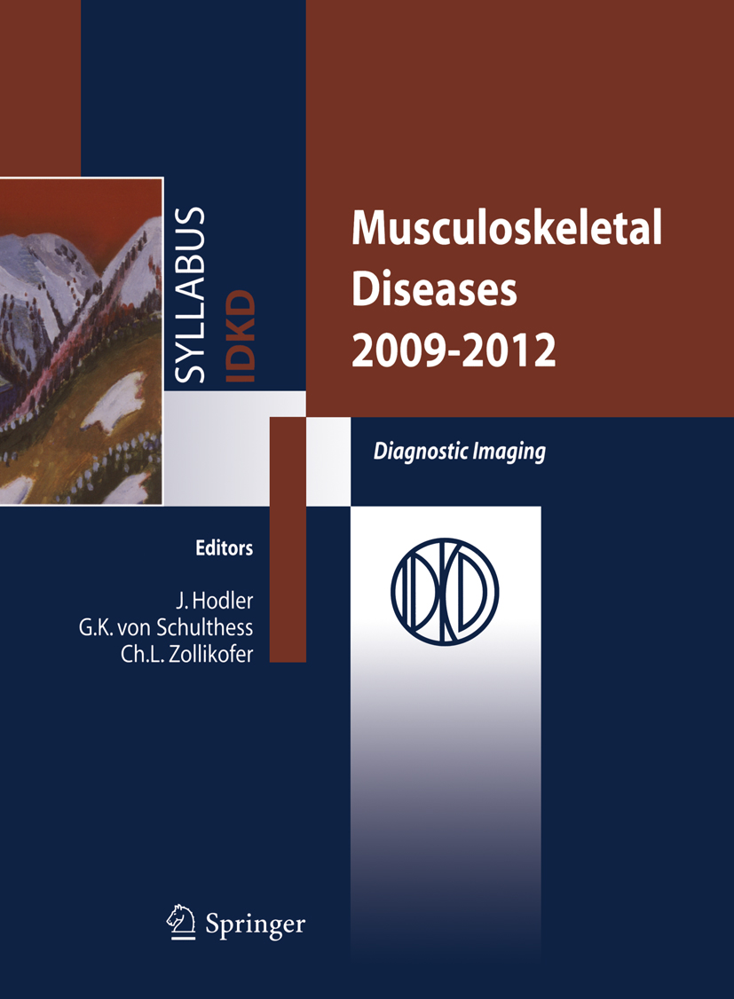 Cover Musculoskeletal Diseases 2009-2012