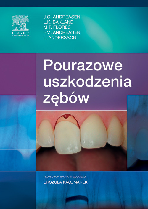 Cover Pourazowe uszkodzenia zebów, wyd. II