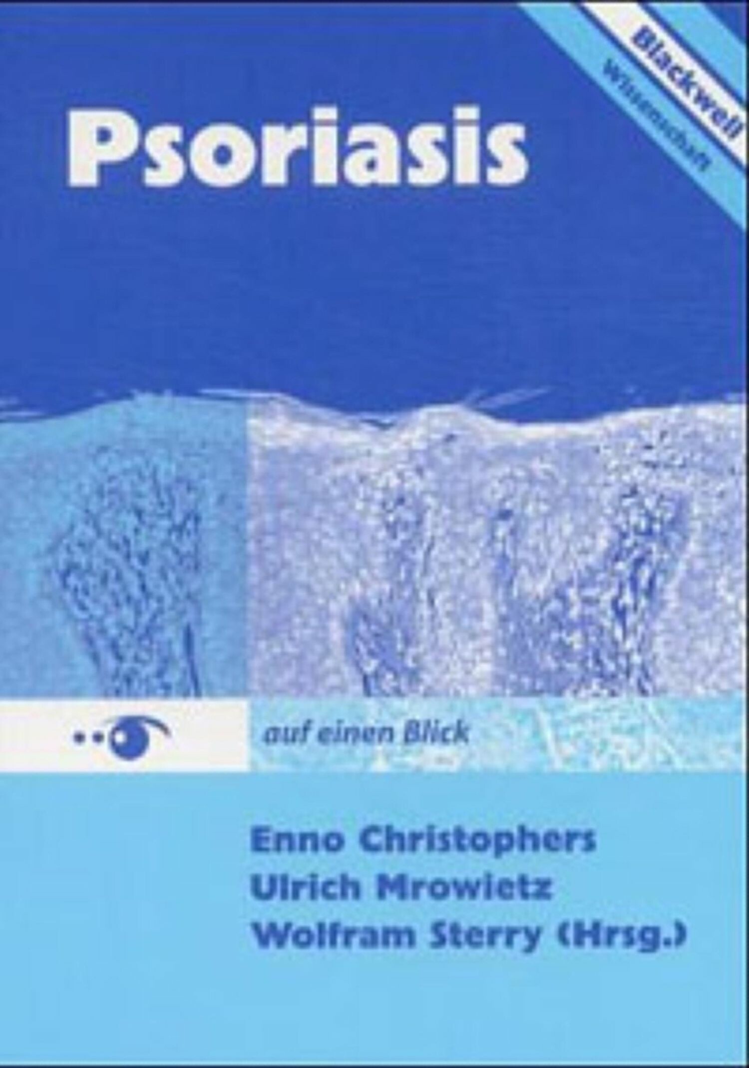 Cover Psoriasis auf einen Blick 3894125470