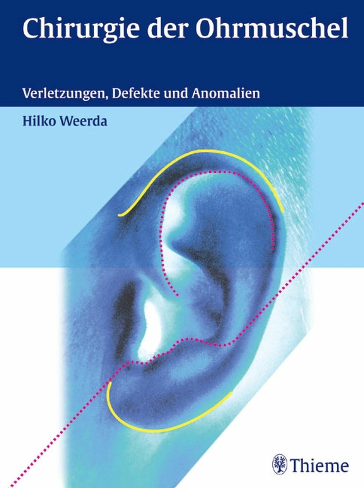 Cover Chirurgie der Ohrmuschel