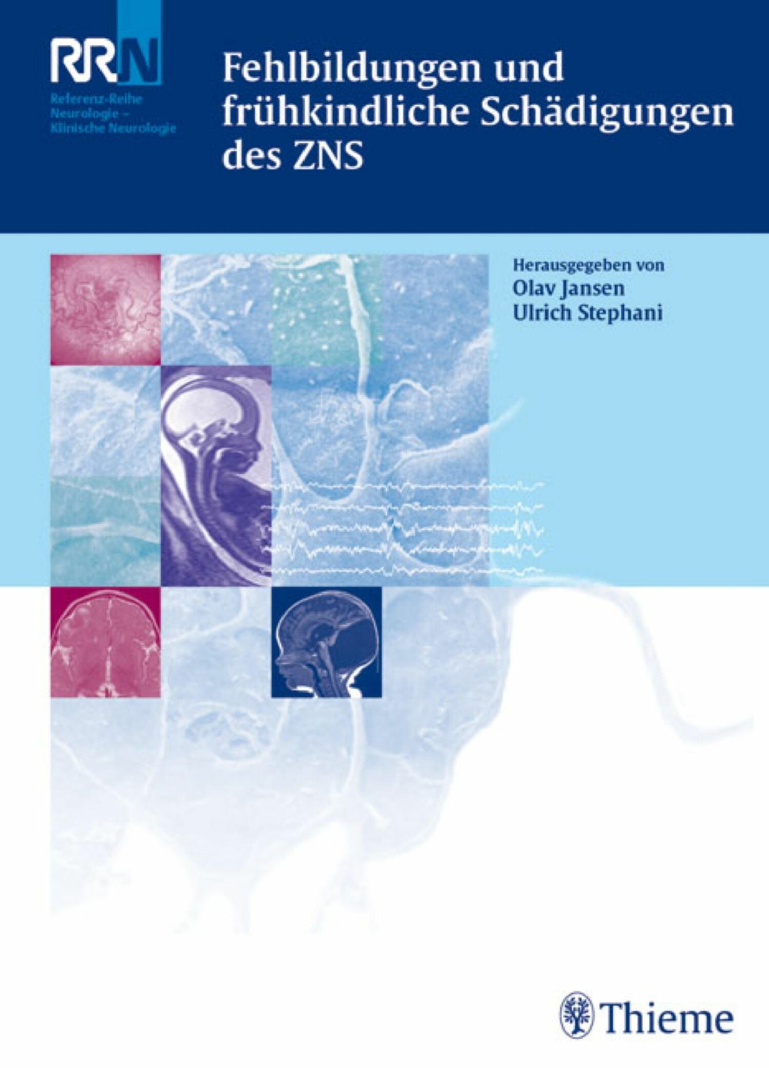 Cover Fehlbildungen und frühkindliche Schädigungen des ZNS