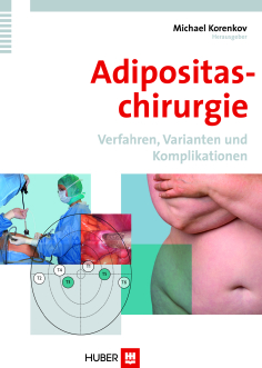 Adipositaschirurgie. Verfahren, Varianten und Komplikationen