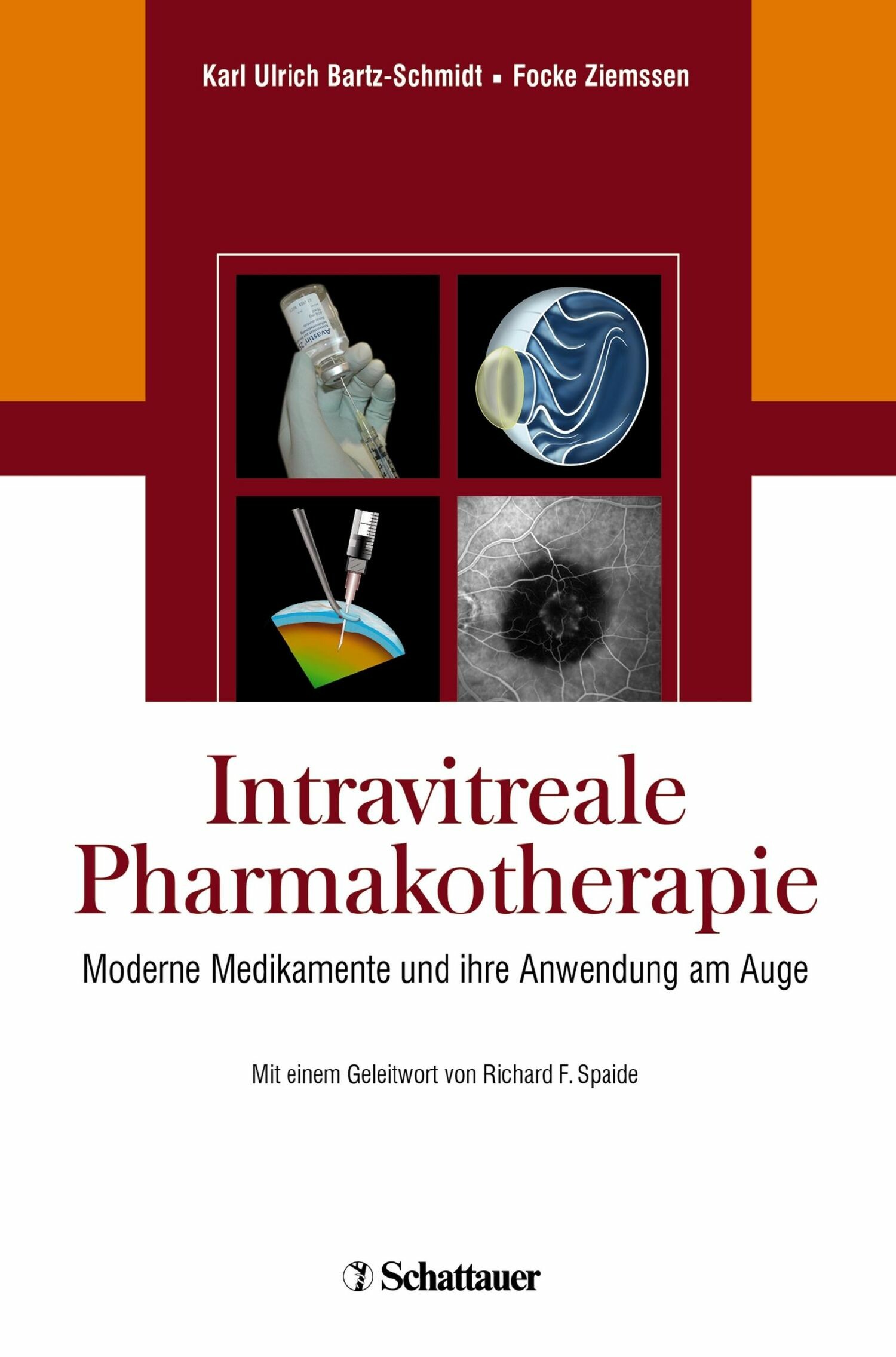 Cover Intravitreale Pharmakotherapie
