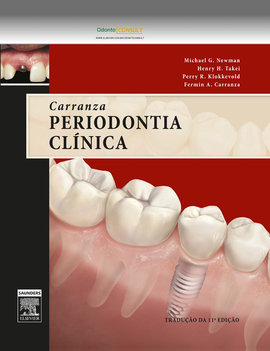 Carranza Periodontia Clínica