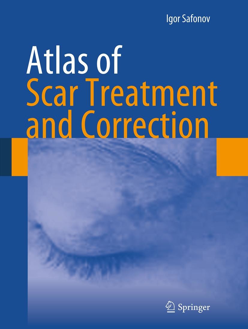 Cover Atlas of Scar Treatment and Correction