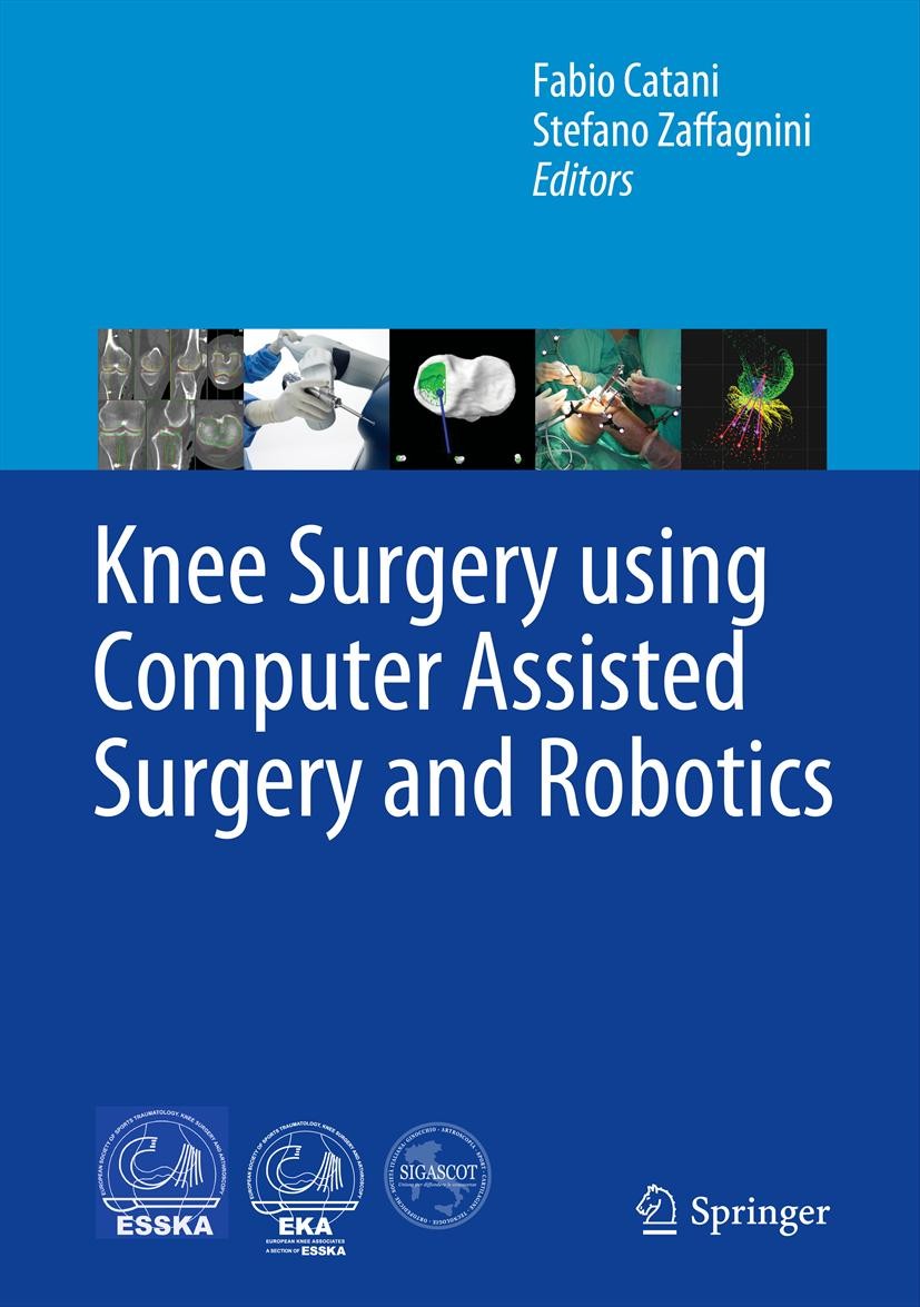 Cover Knee Surgery using Computer Assisted Surgery and Robotics