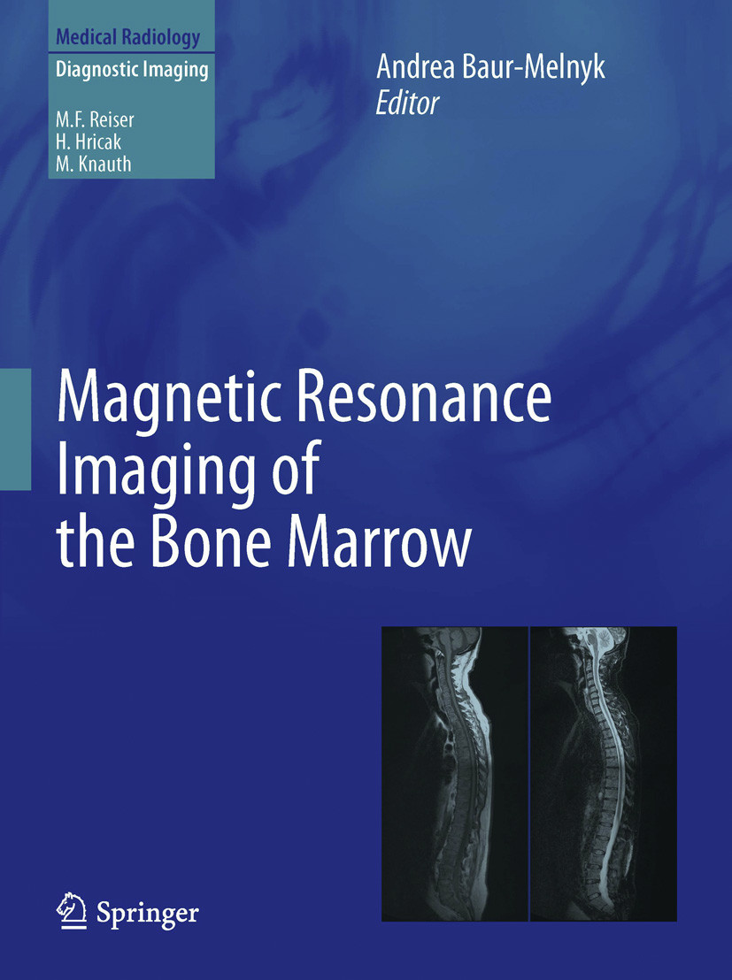 Cover Magnetic Resonance Imaging of the Bone Marrow