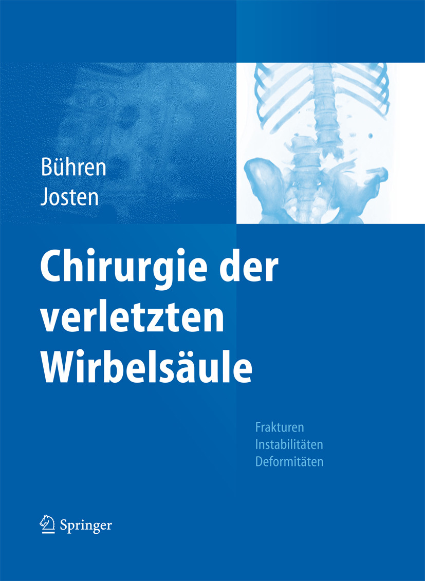 Chirurgie der verletzten Wirbelsäule