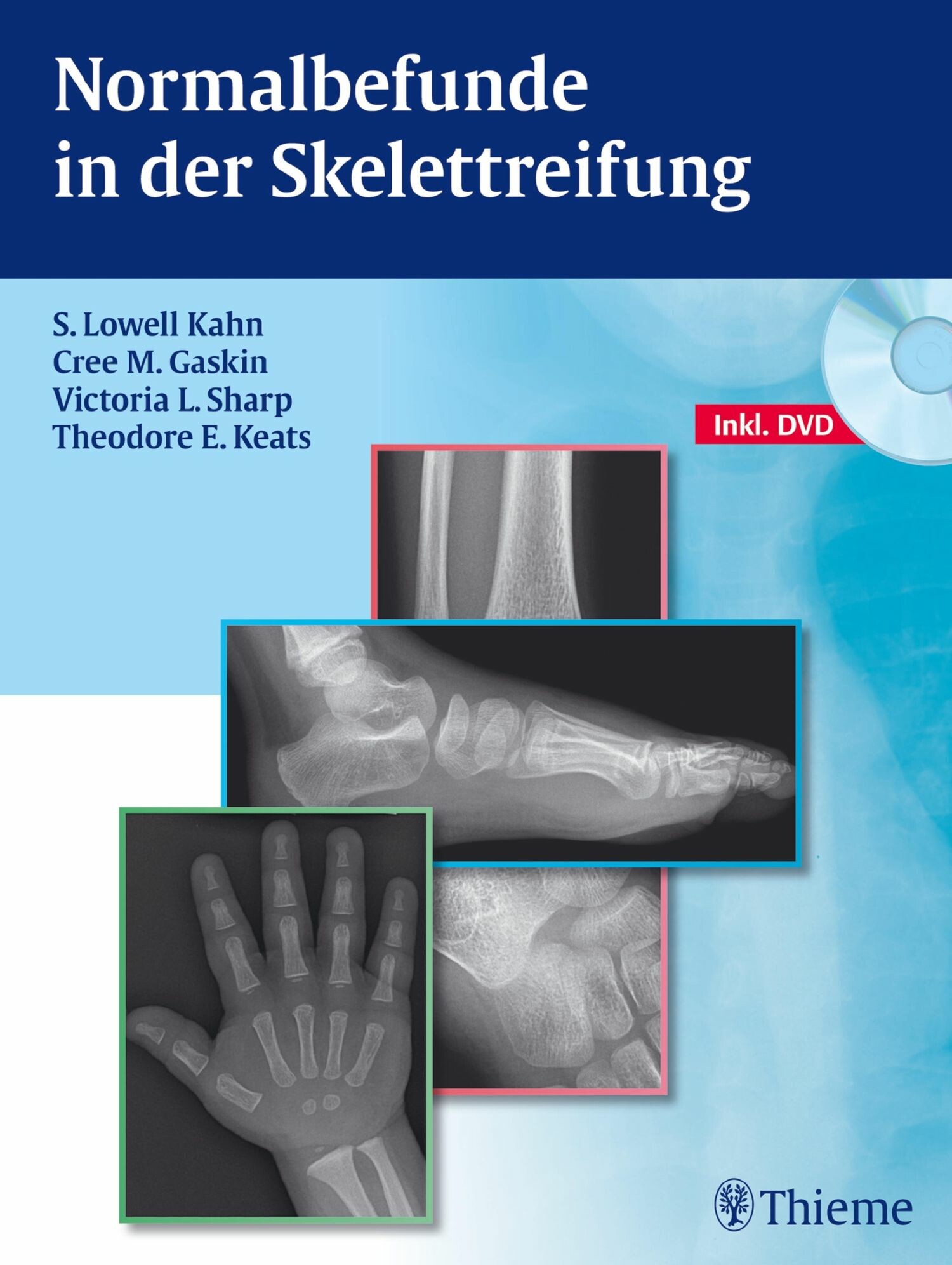 Cover Normalbefunde in der Skelettreifung
