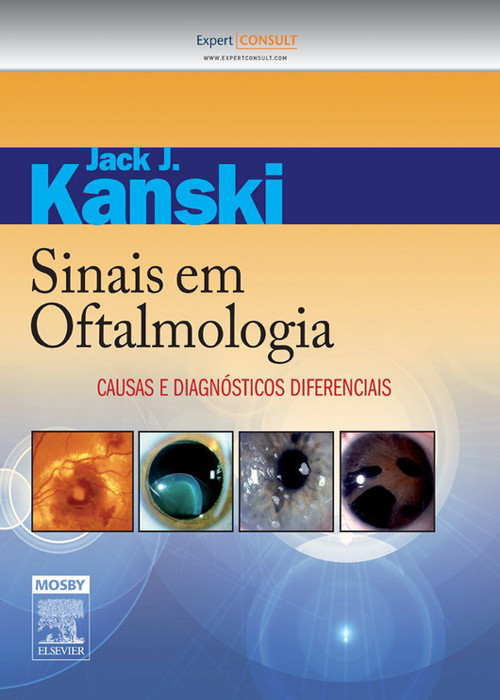 Cover Sinais em Oftalmologia