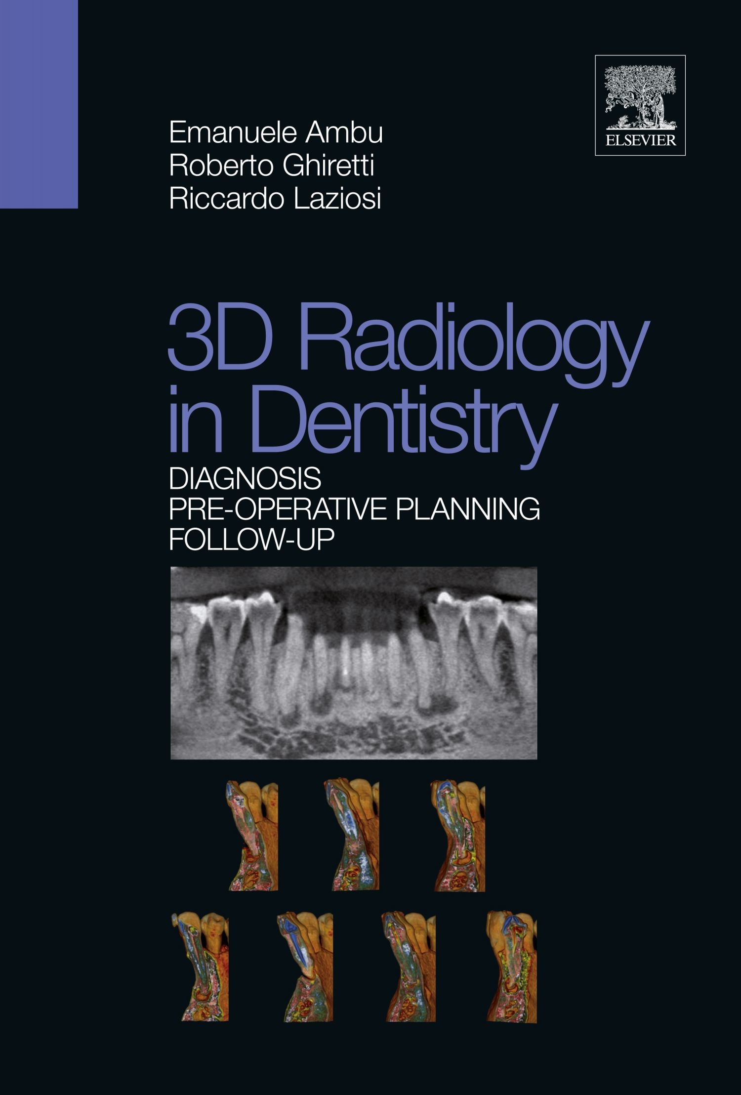 3D Radiology in Dentistry