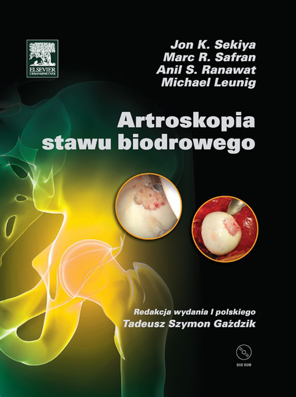 Cover Artroskopia stawu biodrowego