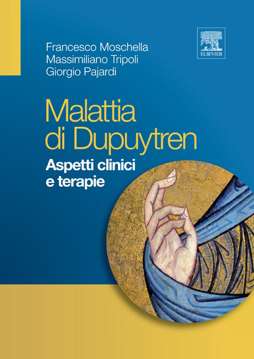Cover Malattia di Dupuytren