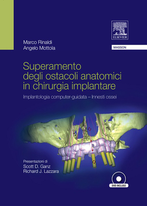 Cover SUPERAMENTO DEGLI OSTACOLI ANATOMICI IN CHIURGIA IMPLANTARE