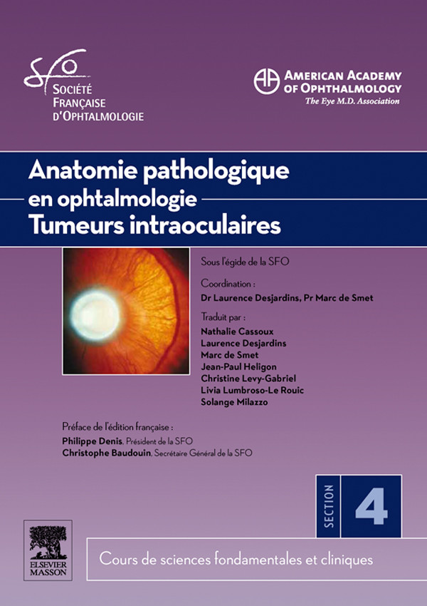 Anatomie pathologique en ophtalmologie. Tumeurs intraoculaires