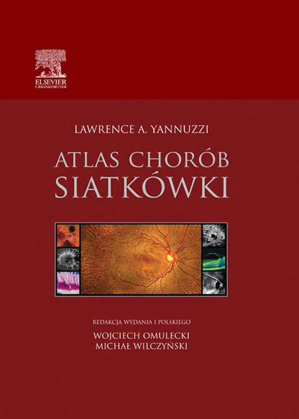Atlas chorób siatkówki