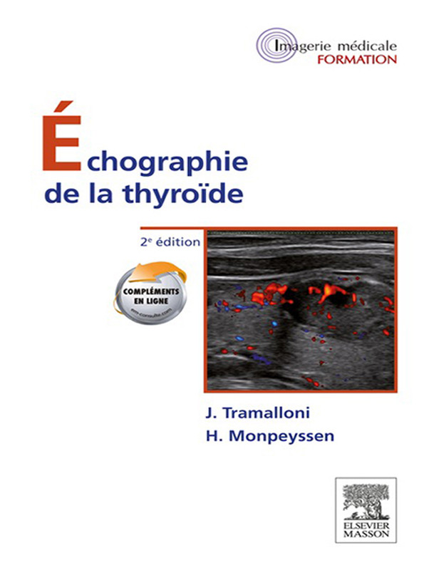 Cover Échographie de la thyroïde
