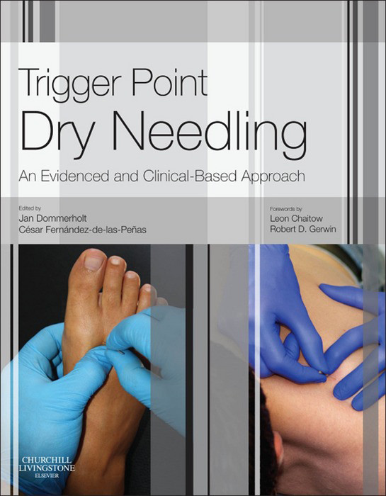 Cover Trigger Point Dry Needling E-Book