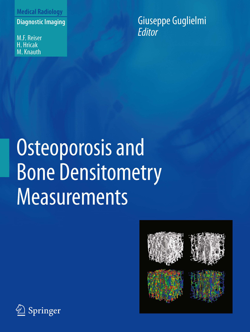 Cover Osteoporosis and Bone Densitometry Measurements