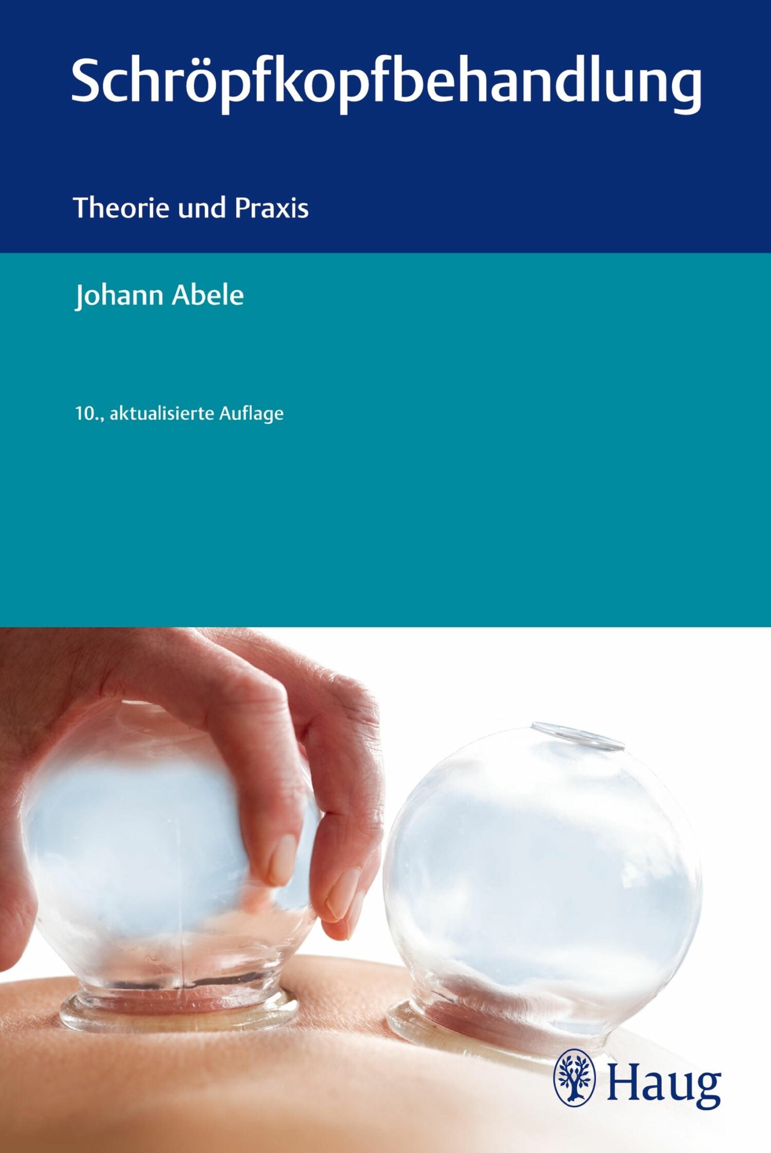 Cover Schröpfkopfbehandlung