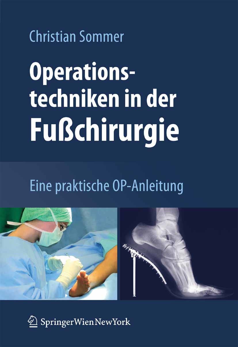 Cover Operationstechniken in der Fußchirurgie