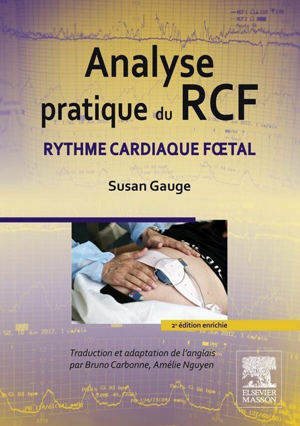 Analyse pratique du RCF