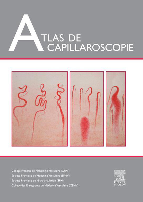 Atlas de capillaroscopie